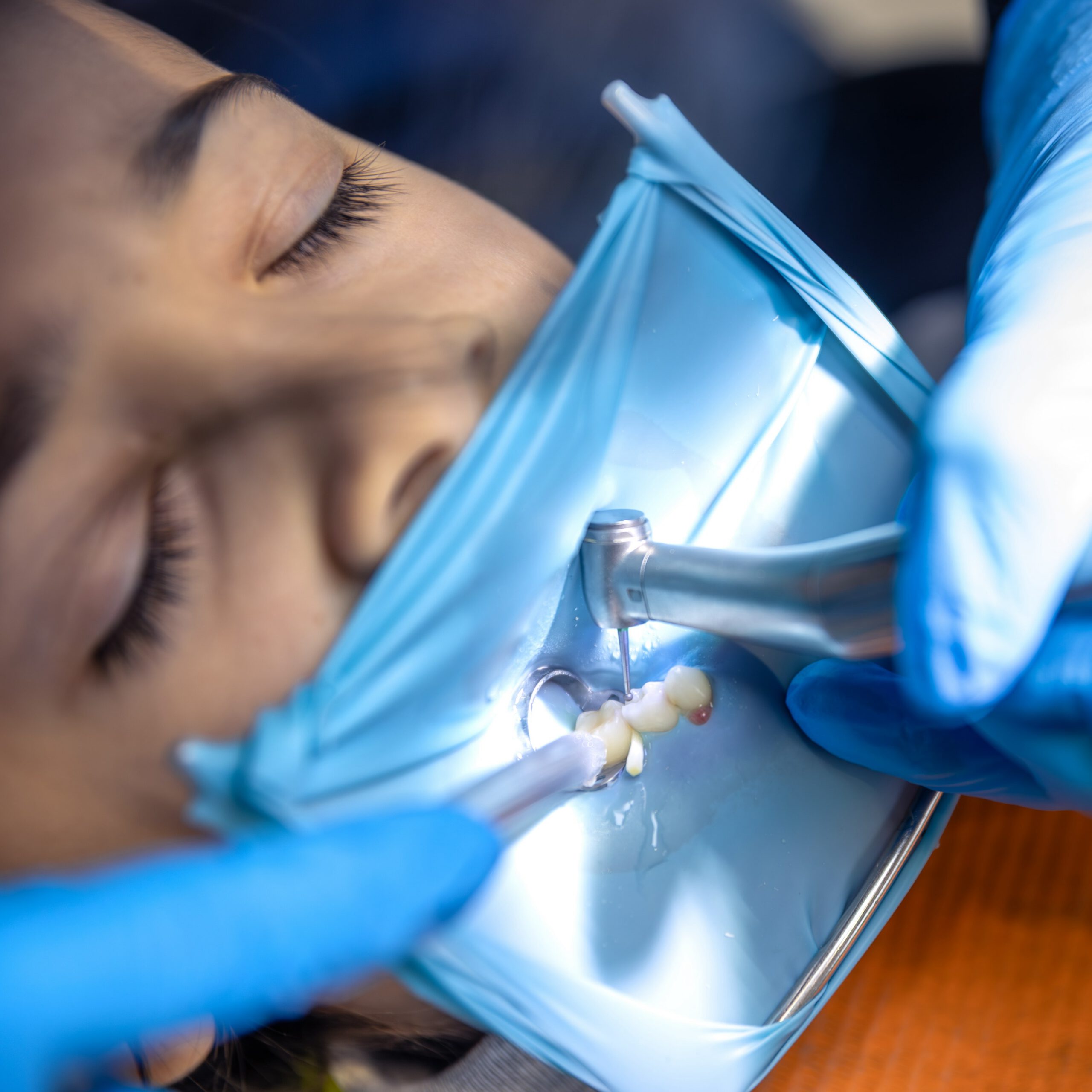 Image by Freepik. Dentist treats child's tooth during sedation.